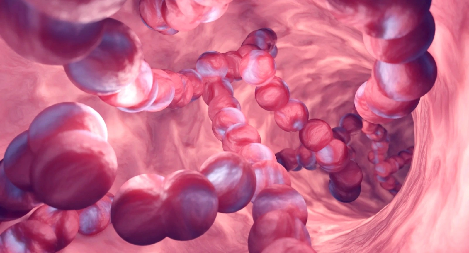 Bactéria carnívora devora genitais