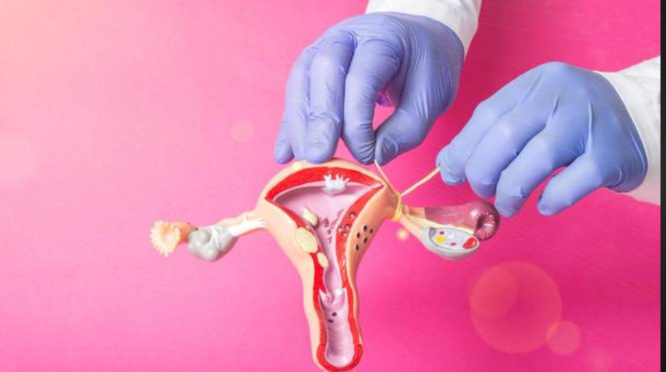 O Ministério da Saúde emitiu nota técnica com orientações para que estados, municípios e o Distrito Federal se adequem às mudanças promovidas pela Lei nº 14.443/2022, qua ampliou o acesso a procedimentos de laqueadura e vasectomia.