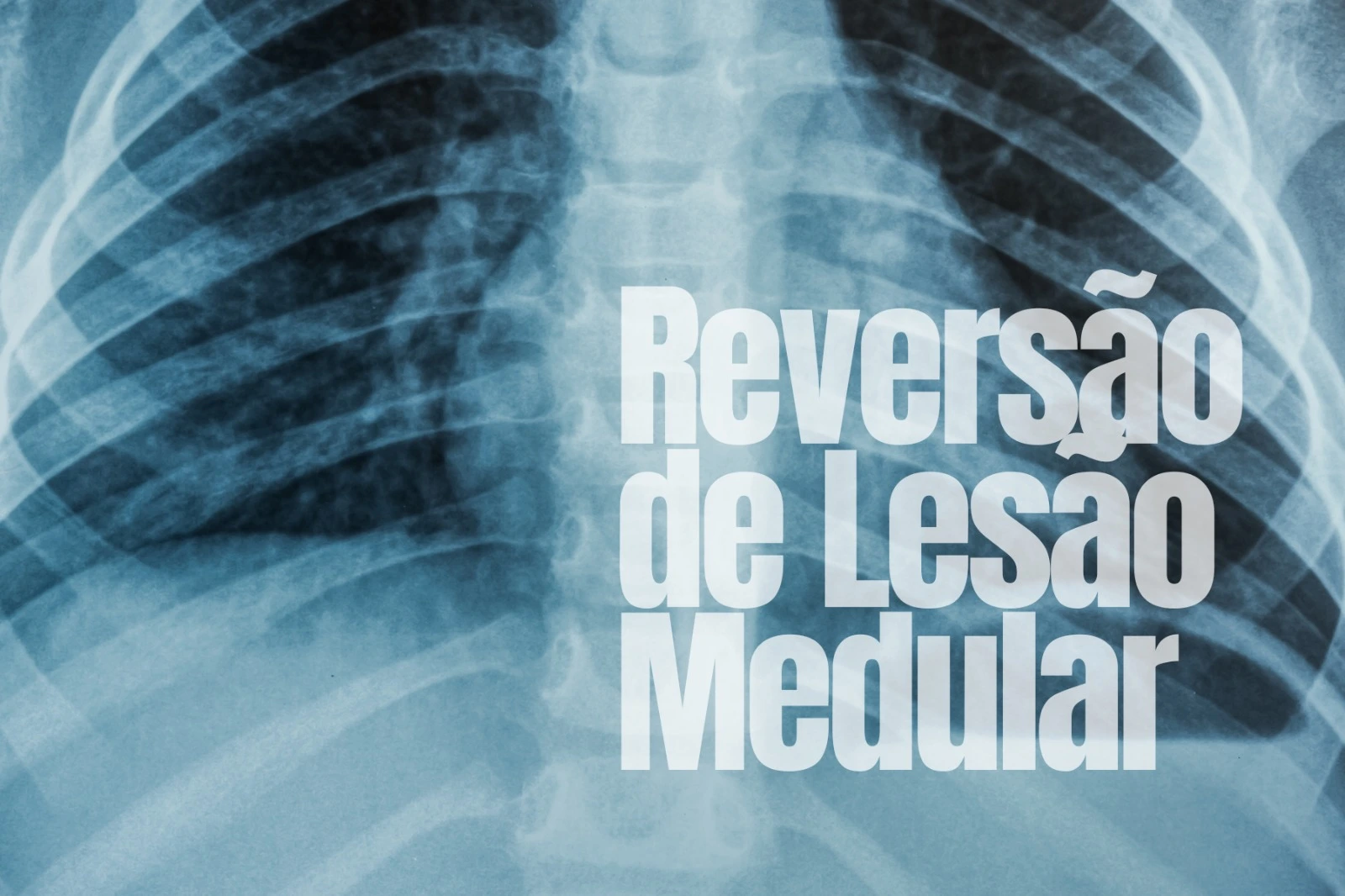 Um grupo de pesquisadores brasileiros apresentou em São Paulo, nesta terça-feira (9), um medicamento inédito com potencial para reverter lesões na medula espinhal.