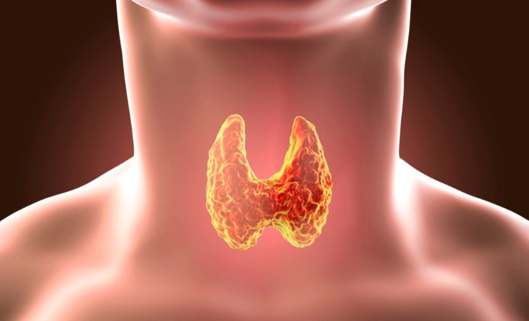 Pesquisadores apontam que o fenômeno tem múltiplas causas combinado avanços no diagnóstico, fatores ambientais e mudança no estilo de vida.