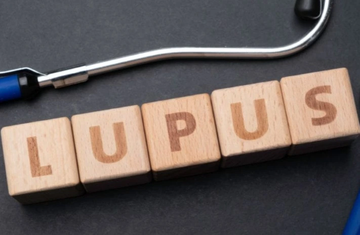 Cientistas da Stanford Medicine identificaram um possível elo entre o lúpus e o vírus Epstein-Barr (EBV), encontrado em mais de 90% dos adultos. A pesquisa indica que o vírus pode reprogramar células B e desencadear respostas autoimunes.