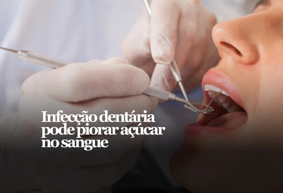 Uma infecção dentária profunda, muitas vezes sem dor, pode manter inflamação baixa e contínua no corpo — e isso pode atrapalhar o controle do açúcar no sangue.