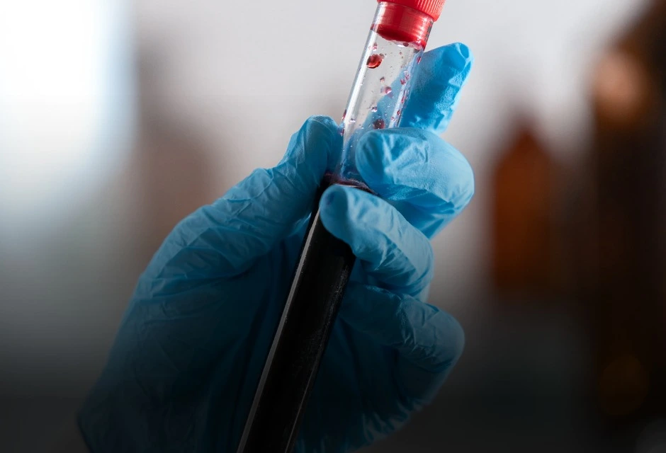 Um teste genético que antes podia levar anos para virar resposta vai entrar na rotina do SUS — e a promessa é encurtar a espera de até 7 anos para cerca de 6 meses.