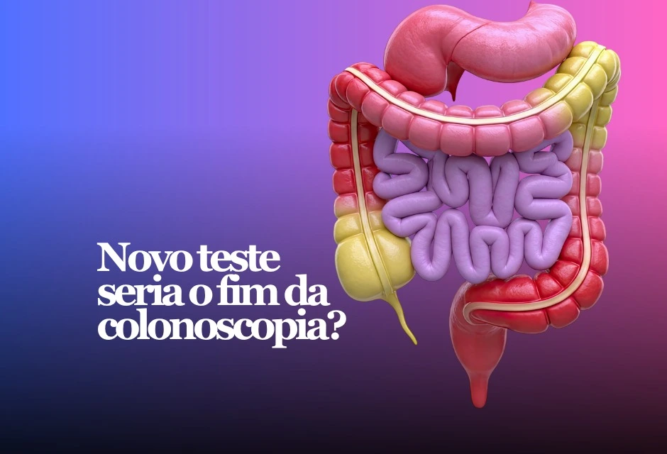 Um exame não invasivo criado por pesquisadores da Universidade de Genebra identificou 90% dos casos de câncer colorretal em análises com amostras de fezes.