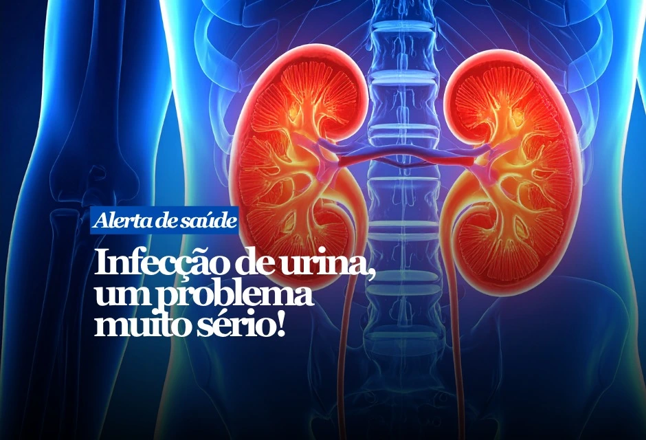 A infecção urinária parece simples, mas pode virar emergência quando sobe para os rins ou evolui para sepse, a infecção generalizada.
