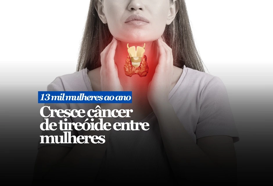 Estimativa do Instituto Nacional de Câncer aponta 16.450 novos casos por ano entre 2026 e 2028. Desse total, 13.310 devem ocorrer em mulheres e 3.140 em homens, uma diferença que mantém o tumor entre os mais associados ao público feminino.