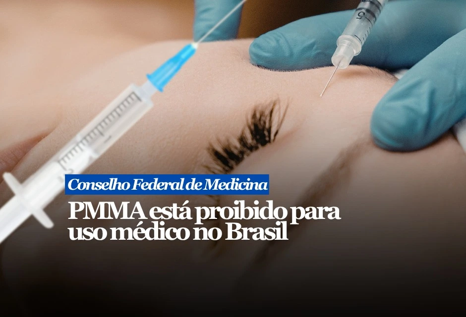 O Conselho Federal de Medicina proibiu o uso médico do PMMA como substância preenchedora em procedimentos estéticos e reparadores no país. A regra passa a valer a partir de terça-feira (2), com a publicação da Resolução nº 2.461/2026 no Diário Oficial da União.