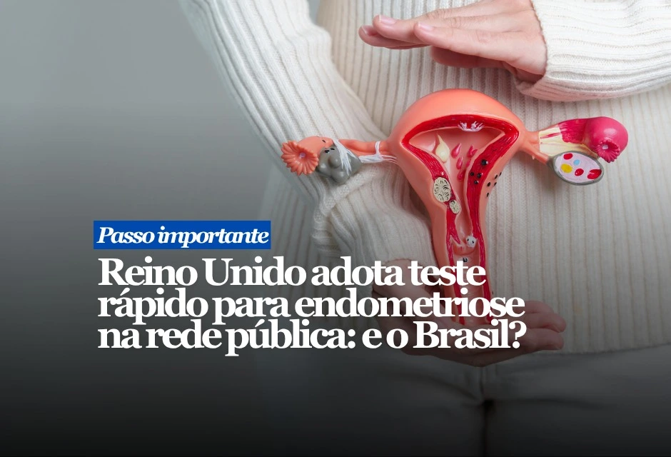 A Inglaterra e o País de Gales deram um passo que interessa diretamente ao Brasil: dois testes não invasivos para endometriose devem entrar no sistema público de saúde britânico por três anos, enquanto novos dados são coletados. O Endotest analisa uma amostra de saliva em busca de microRNAs, pequenos marcadores biológicos associados à doença. O Endosure mede sinais elétricos do intestino por sensores colocados no abdômen e entrega resultado em cerca de 45 minutos. Os dois exames não funcionam sozinhos: servem para apoiar a decisão médica quando há suspeita de endometriose e exames de imagem negativos, inconclusivos ou indisponíveis.