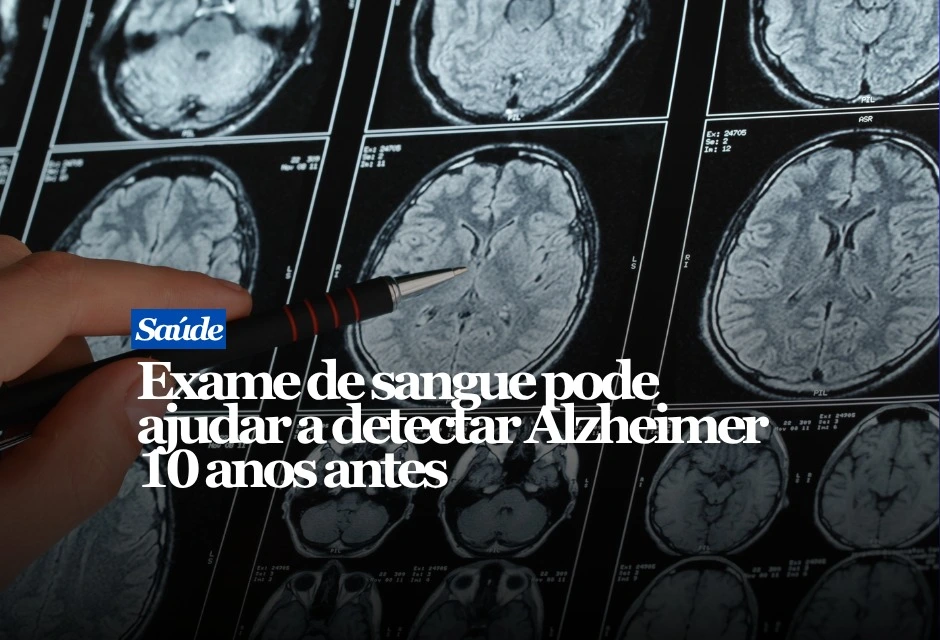 Um exame de sangue que mede a proteína p-tau217 pode ajudar a identificar idosos sem problemas de memória que apresentam maior risco de desenvolver comprometimento cognitivo nos cinco a dez anos seguintes. O estudo, publicado na revista JAMA, acompanhou 2.684 adultos cognitivamente saudáveis de pesquisas realizadas na América do Norte, Austrália e Japão.
