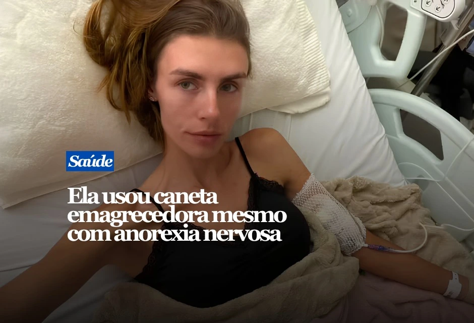 Joana Purin, de 28 anos, passou 20 dias internada após chegar a um quadro grave de desnutrição e ser diagnosticada com anorexia nervosa. Agora, a modelo usa as redes sociais para mostrar a recuperação e falar sobre uma doença que, segundo ela, ainda provoca recaídas emocionais durante as refeições. Joana conta que a relação problemática com o peso começou em 2021, enquanto trabalhava como modelo. Em 2025, após perdas pessoais e um quadro depressivo, voltou a emagrecer e passou a buscar um corpo cada vez mais magro.