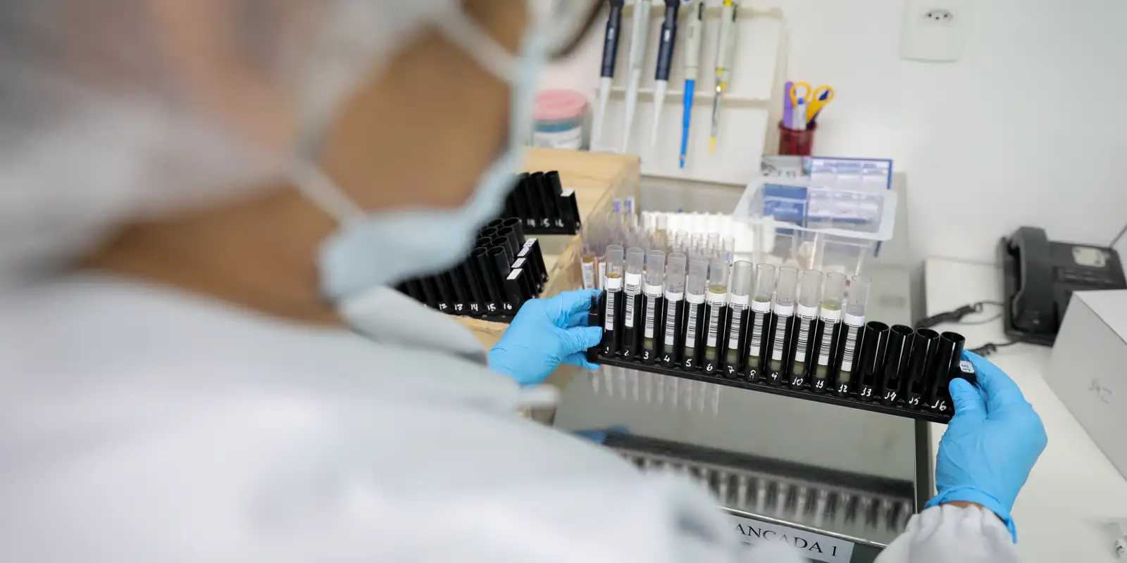 Anvisa aprova testes em humanos para vacina brasileira contra malária