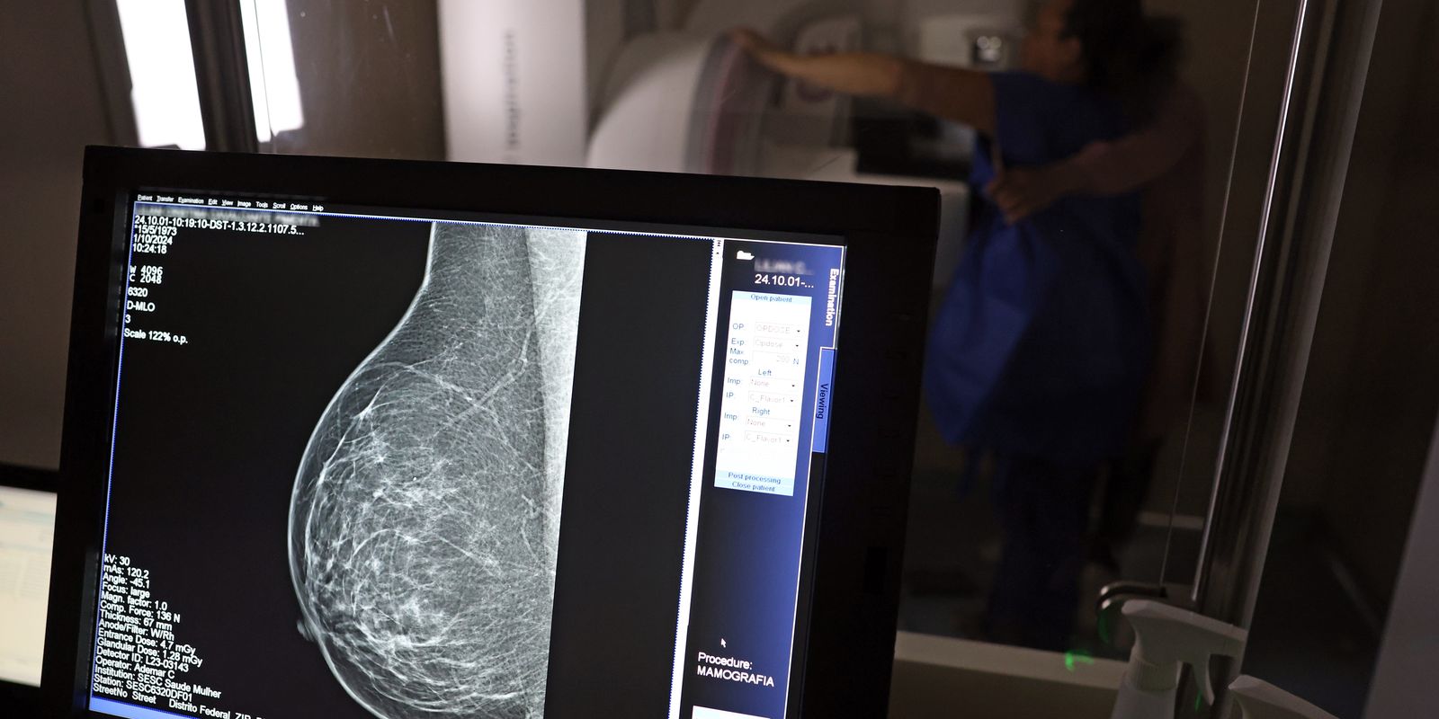 Organizações médicas lançam diretrizes para facilitar acesso à mamografia digital