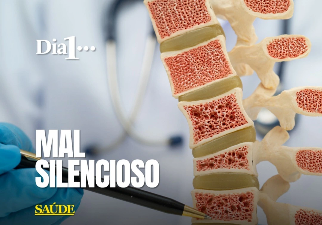 O Dia Mundial da Osteoporose, celebrado nesta terça-feira (20), chama atenção para uma doença que pode enfraquecer os ossos durante anos sem provocar sintomas evidentes. A campanha internacional de 2026 destaca a importância de preservar a saúde óssea ao longo da vida, com alimentação adequada, atividade física e identificação dos fatores de risco.